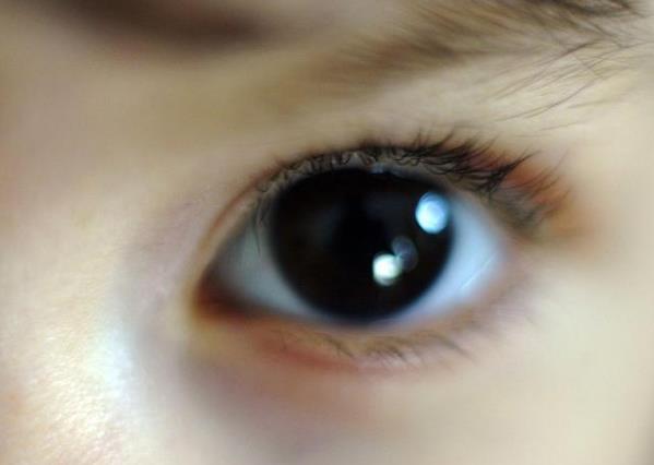 長(zhǎng)期睡前玩手機(jī)的人，面部若有3癥狀，可能是肝在“吐槽”