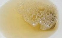 ?蛋白尿吃什么藥好得快